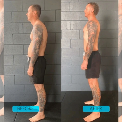 Instant Posture Corrector